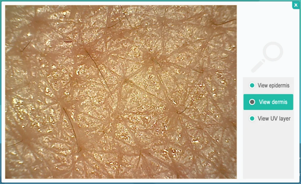 Через лупу на коже можно рассмотреть. Кожа под увеличительным стеклом. Рассмотрите кожу через лупу.