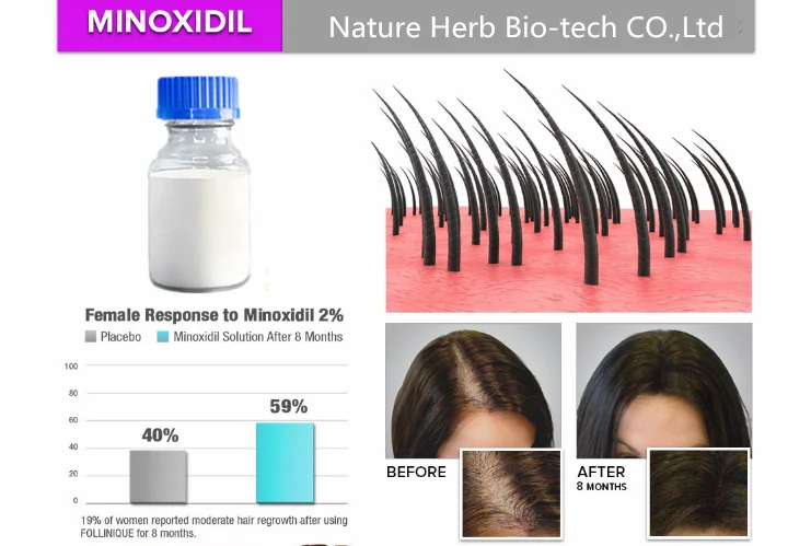 minoxidil.2.png