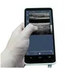 portable mini doppler ultrasound machine for health test