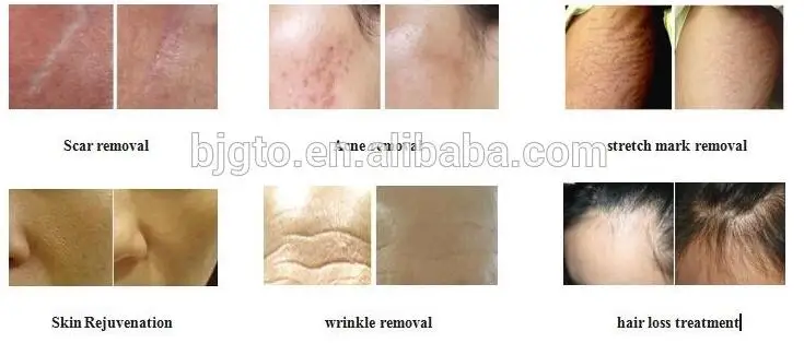 before and after.jpg