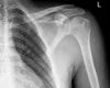 14x17 xray medical x-ray images film for thermal imaging googles