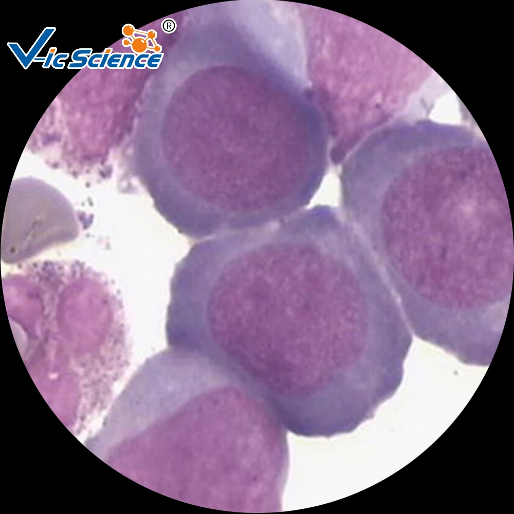 
Hematology Prepared Slides Blood Smear Prepared Slides 