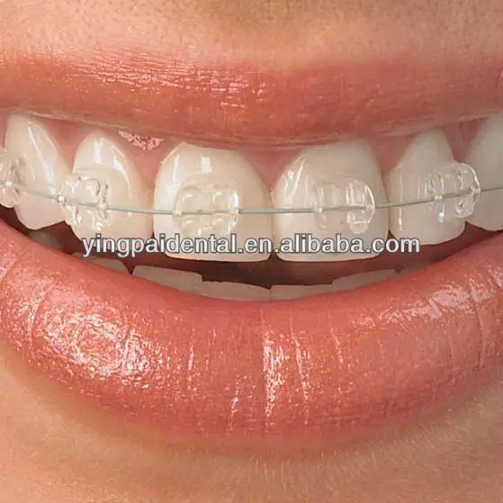 Dental Orthodontic Ceramic Brackets Braces Buy Dental Orthodontic
