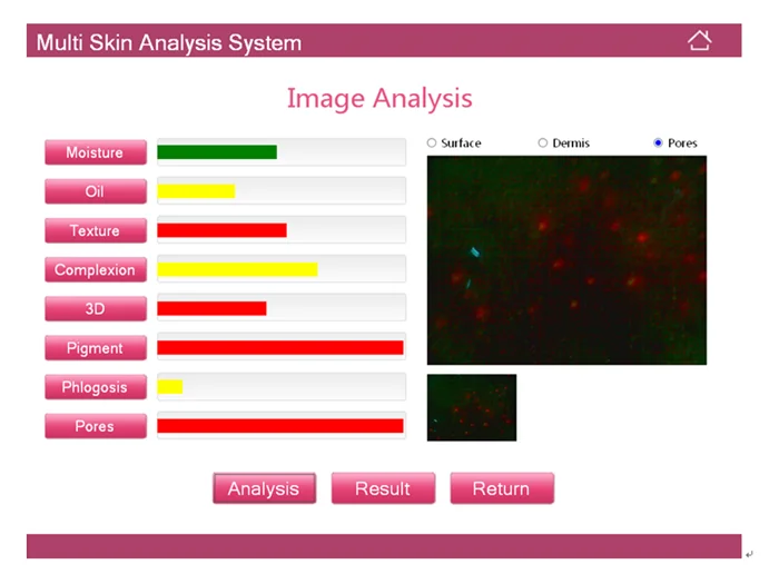 skin analyzer2 (8).png