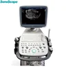 SonoScape S11 Color Doppler Diagnostic Ultrasonic Medical Equipment with FDA
