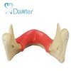 Implant practice model dental teeth model with gum for doing a comprehensive implant practice like incision and implant