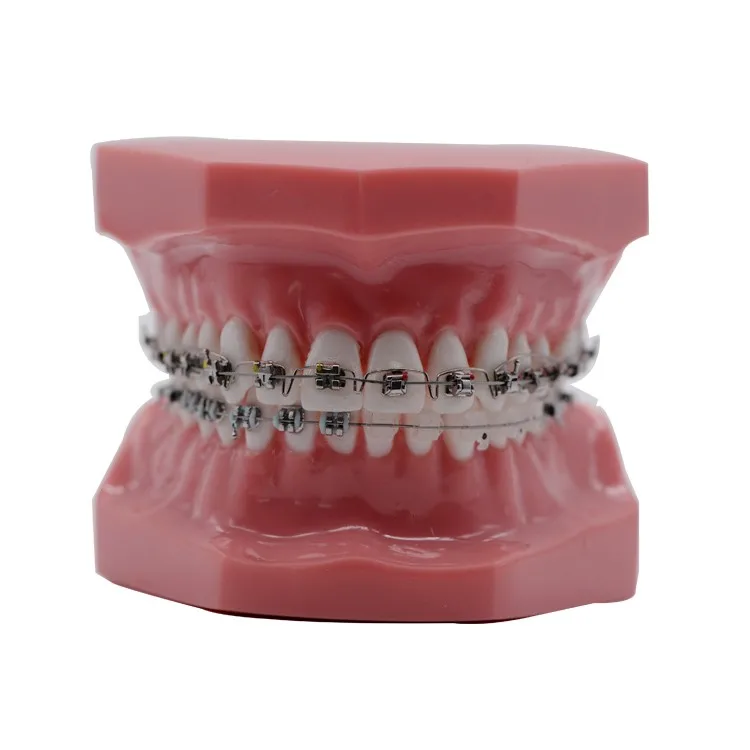 Mim Standard Or Mini Dental Braces Orthodontic Metal Bracket Buy