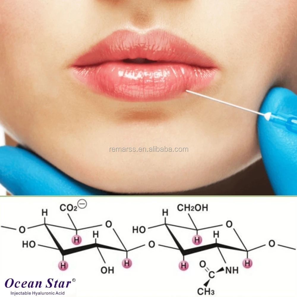 

2019 High quality hyaluronic acid korea dermal face filler 1ml lip filler injections