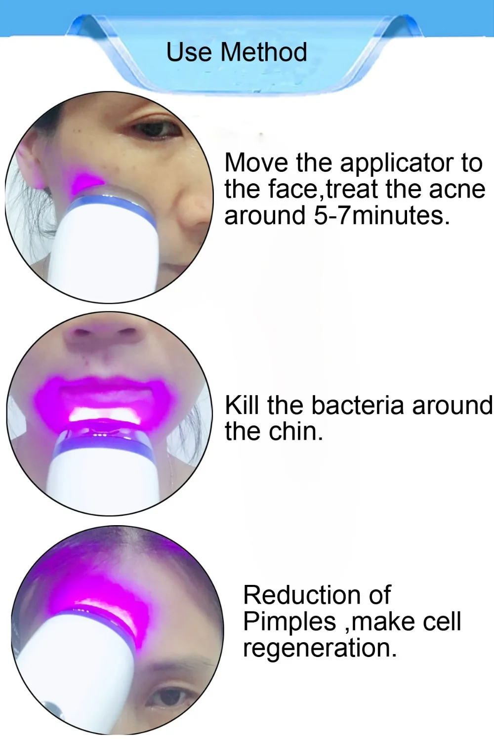 Best Seller Electric Blue Led Light Acne Therapy Solution Acne Removal