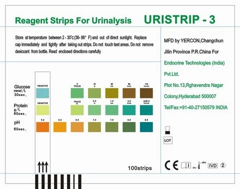 
urine dipstick 