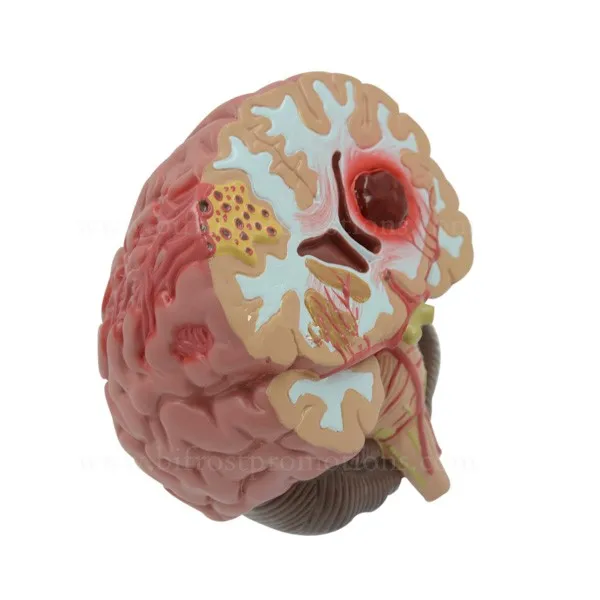 BP72106 brain model 4w