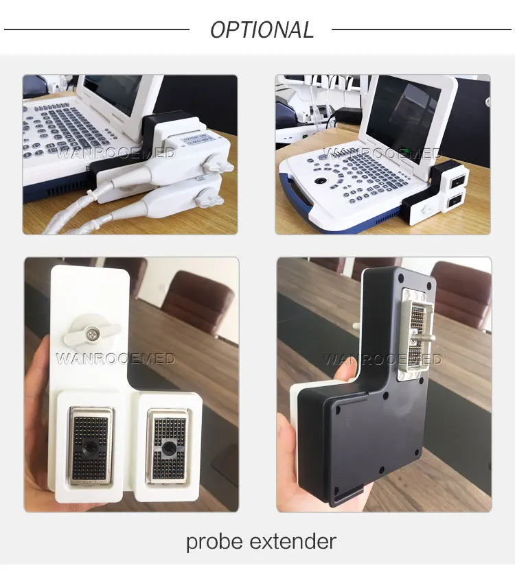 Ultrasound Machine, 4D Ultrasound,Doppler Ultrasound Machine,Portable Ultrasound,Portable Ultrasound Machine Machine à ultrasons, Ultrason 4D, Machine à ultrasons Doppler, Ultrason portable, Machine à ultrasons portable