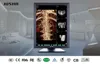 128 (JUSHA-C23C )dental intraoral x-ray scanner,old lcd monitor