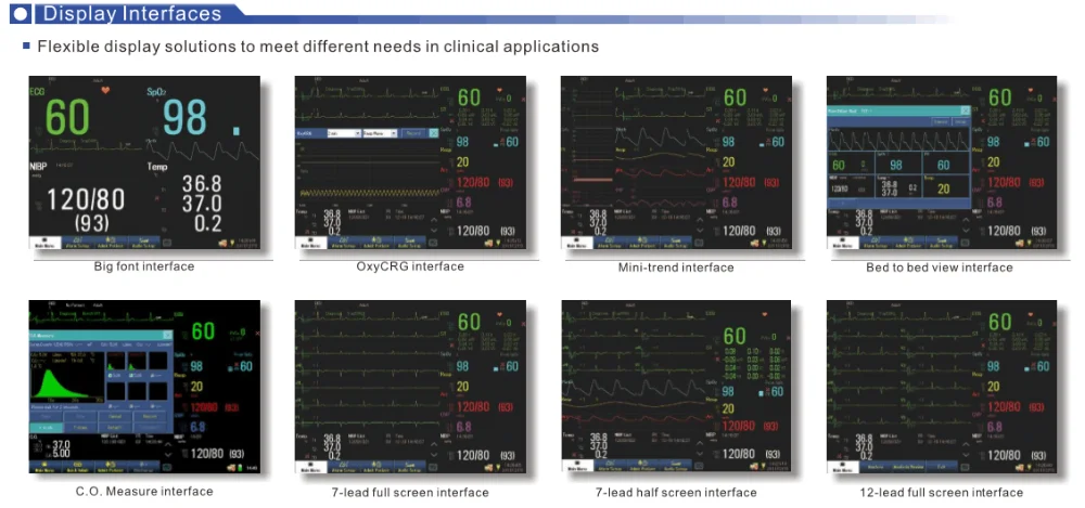 China! High performance cost multiparameter patient monitor on sale.