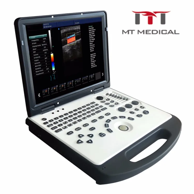 China Wireless Portable Ultrasound Machine For Pregnancy