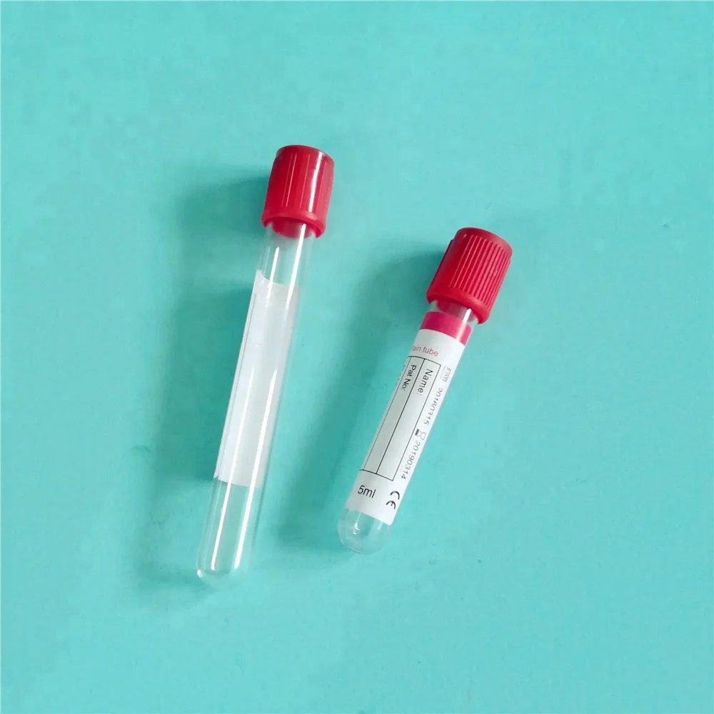 blood test tube.jpg