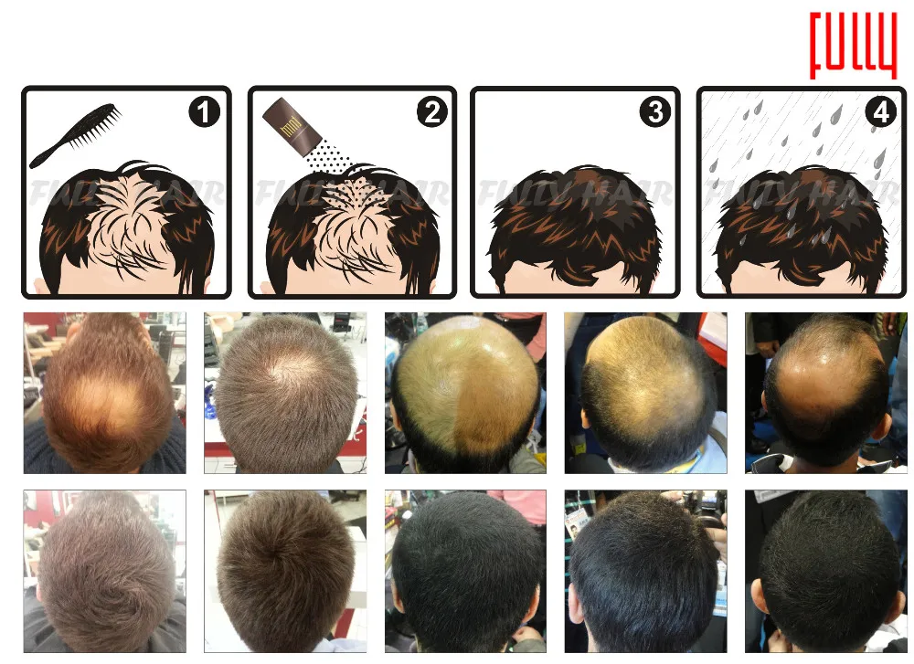 Hemp Protein Powder Hair Loss Causes Itchy Thinning Scalp