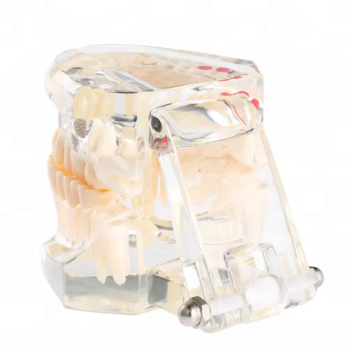 
Hot Sale Resin Dental Implant Model 