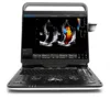 Ultrasound device with high technology /Famosa marca Chison EBit 60 medico Ultrasonido/ecografo