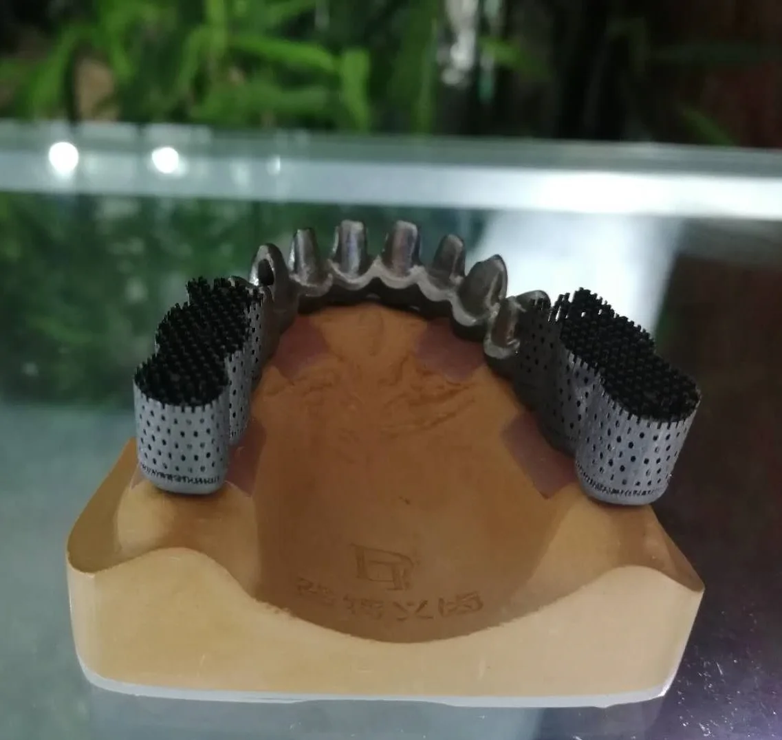 Oem Dental Implant Abutment Dental Implant Dental Implant Teeth Buy
