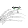 24 hours feedback Mini-fixator (finger&palm) orthopedic device