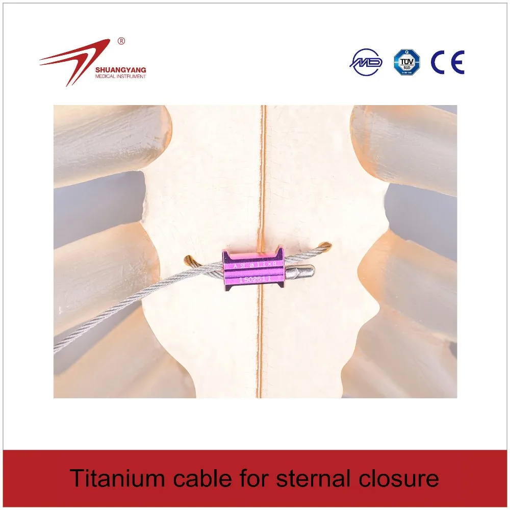 Titanium cable for sternal closure