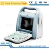 Cheap and high quality full digital portable ophthalmicA/B ultrasound scanner MSLPU22-E