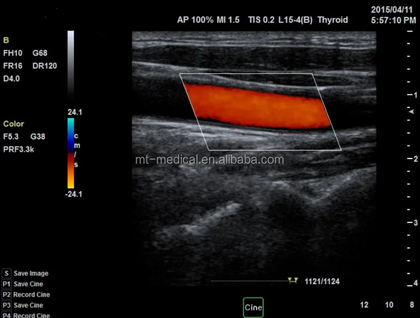 Medical Ultrasound More Than Two Probe Socket Portable Scanner