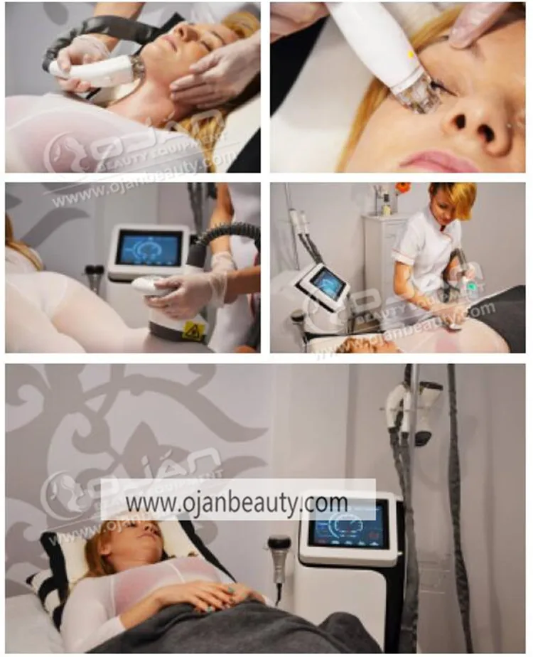 velashape SE-106 (9)