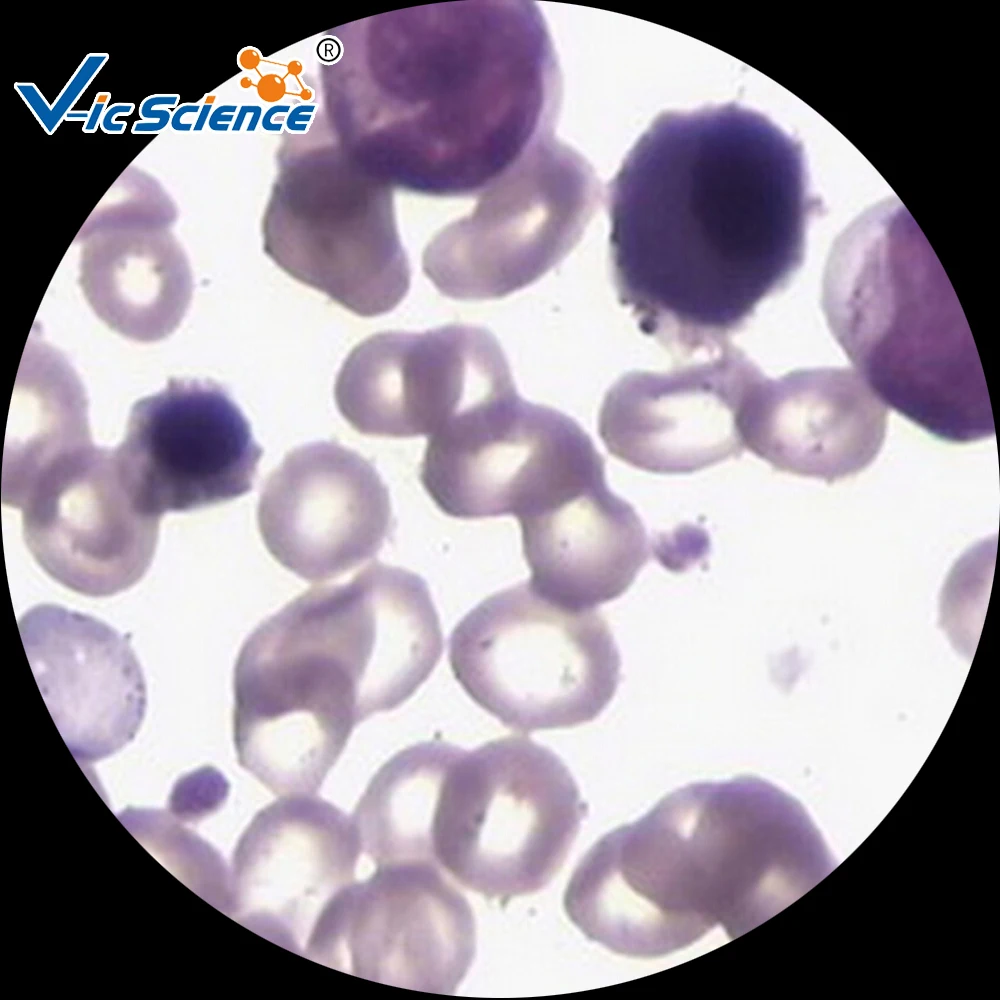 
Hematology Prepared Slides Blood Smear Prepared Slides 