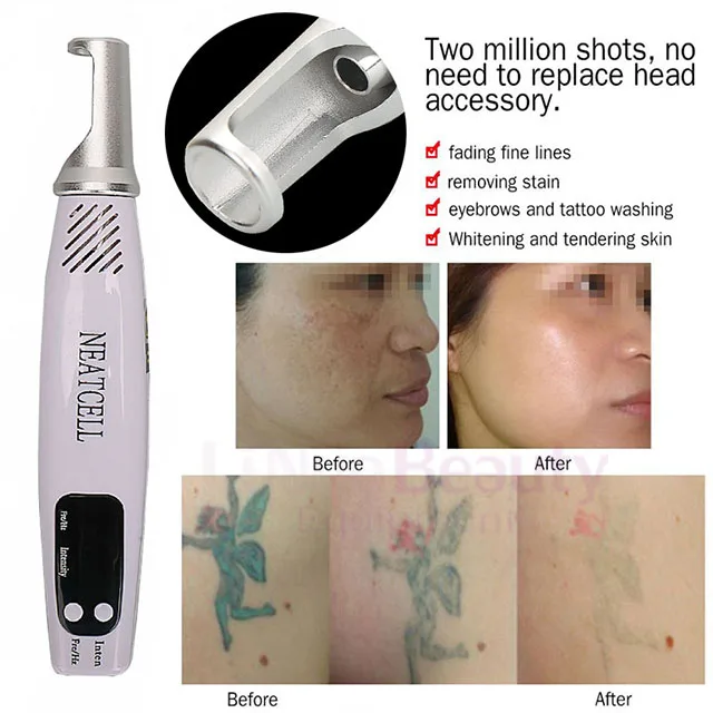 picosecond laser pen 755nm tattoo removal machine