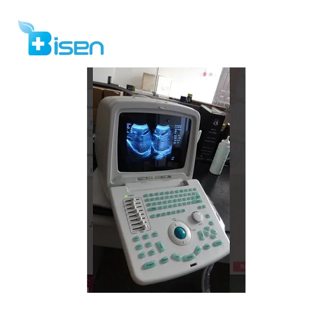 
Cheap powerful function ultrasound scanner with convex array probe pretty and portable appearance 