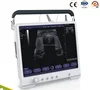 laptop ultrasound machine, CE Fully Digital Laptop Ultrasound, 15"LCD Portable Ultrasonic Test Equipment with USB port