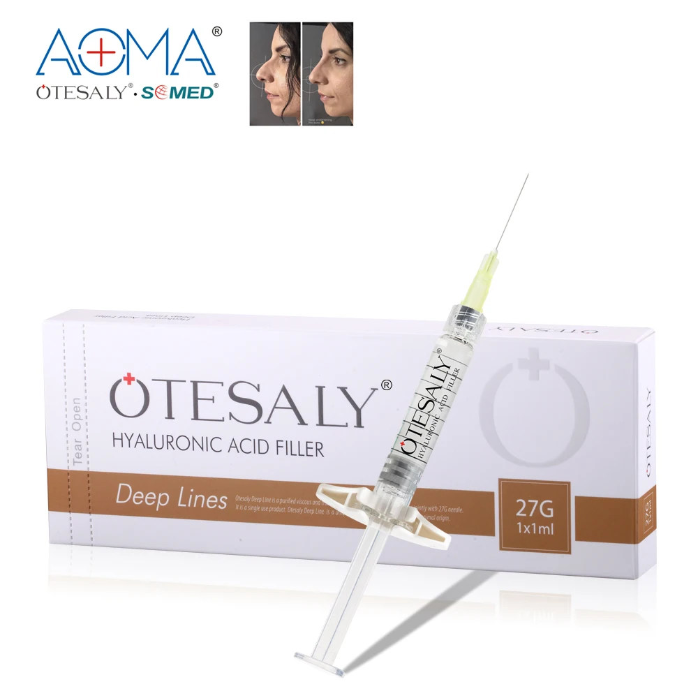 

CE Proved OTESALY 1ml Deep lines filler cido hialurnico Injection for Nasolabial Folds and Deep lines, Transparent colorless