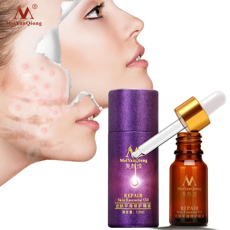 

Scar Repair Skin Serum Oil Lavender Serum Skin Care Natural Pure Remove Ance Burn Strentch Marks Scar Removal Treatment