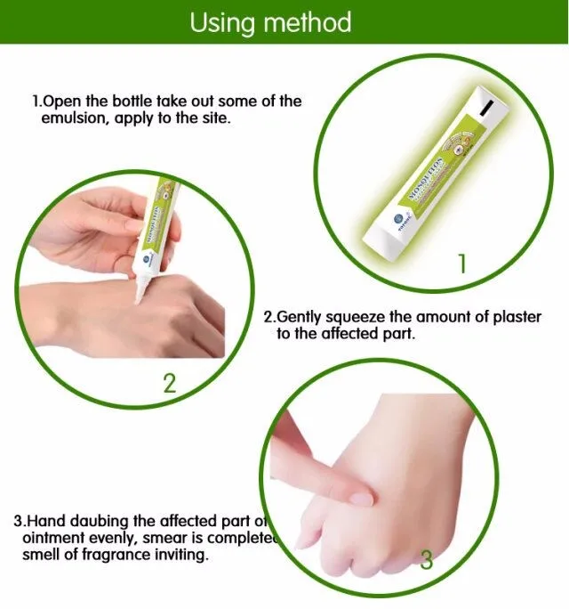 2018 Best Anti-Itch/Rash Cream Products anti-Itch Ointment for Mosquito Repellent Cream