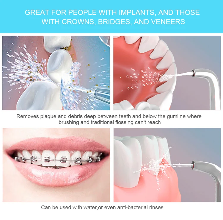 Home Use Manual Water Floss Oral Irrigator New Dental Products - Buy ...