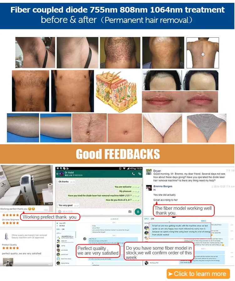 808nm Lamis Painless Ladies Treatment Vagina Epilator 810nm Diode Laser Hair Removal For Sale Buy Painless Ladies Vagina Hair Removal Lamis 810nm Diode Laser For Hair Removal Treatment Epilator 808nm Diode Laser Hair