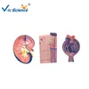 Medical Anatomical Student Teaching Kidney model,nephron model,renal corpuscle model