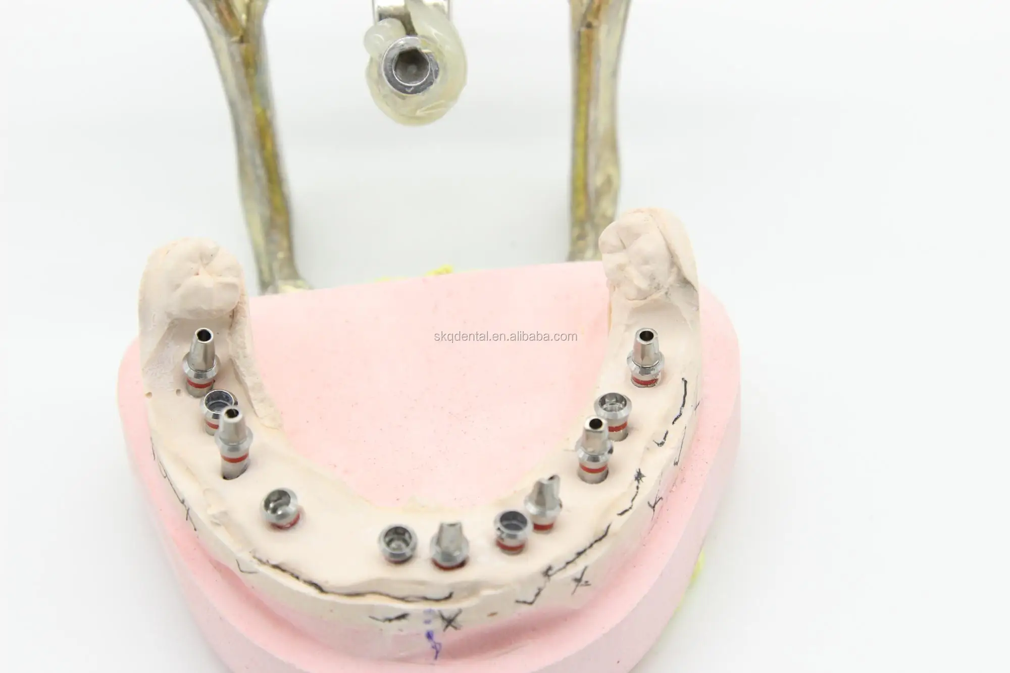 Compatible With Dentium Impression Coping Pick Up/ Dental Implants Transfer Impression/dental