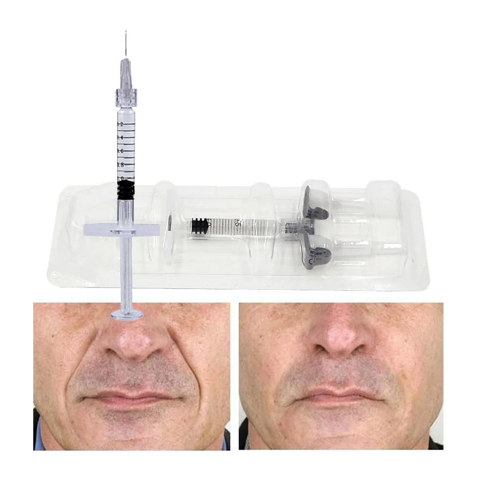 

nasolabial folds treatment 1ml syringe injectable dermal filler