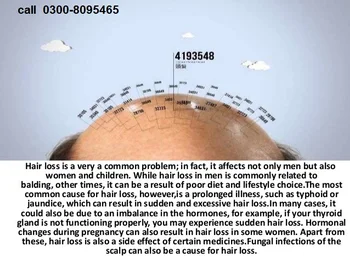 3 Nutrifolica Hair Regrowth Growth Shampoo Natural Stop Loss Thin