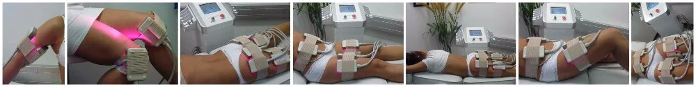 Professional CE Approved lipo laser slimming machine with 209mw lamp
