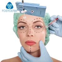 

Fosyderm 2ml Buy Injectable Dermal Fillers Calcium Hyaluronic Acid for Facial Plastic