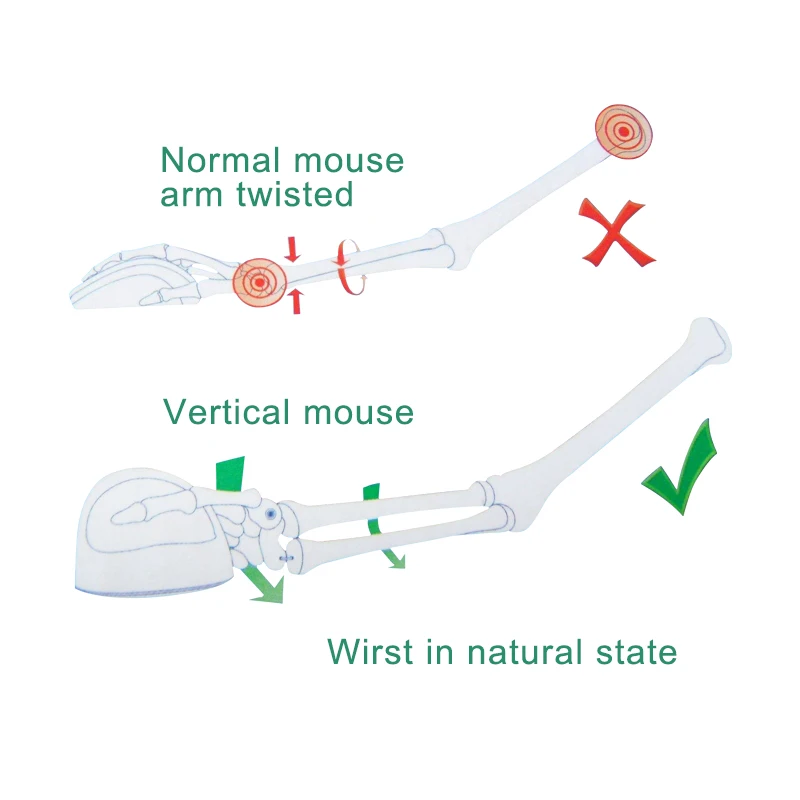 SUNGI Factory Supply Computer Accessories 5D Wired Vertical Mouse Ergonomic Protect Your Wrist