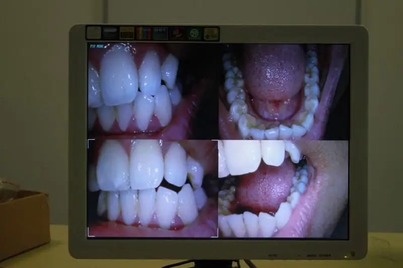 2018 Newest 17 inch tooth Scanner intraoral camera with lcd monitor/lcd monitor intraoral camera
