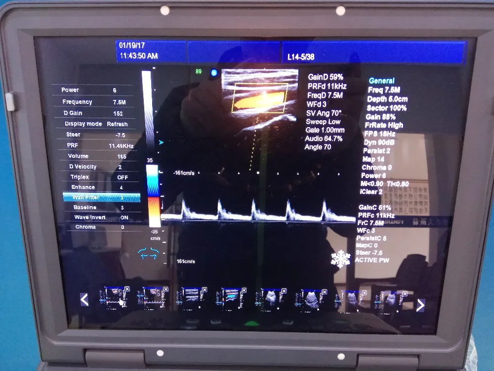 Doppler color Ultrasonido equipos Laptop/portable 3d ultrasound scanner portable color doppler ultrasound