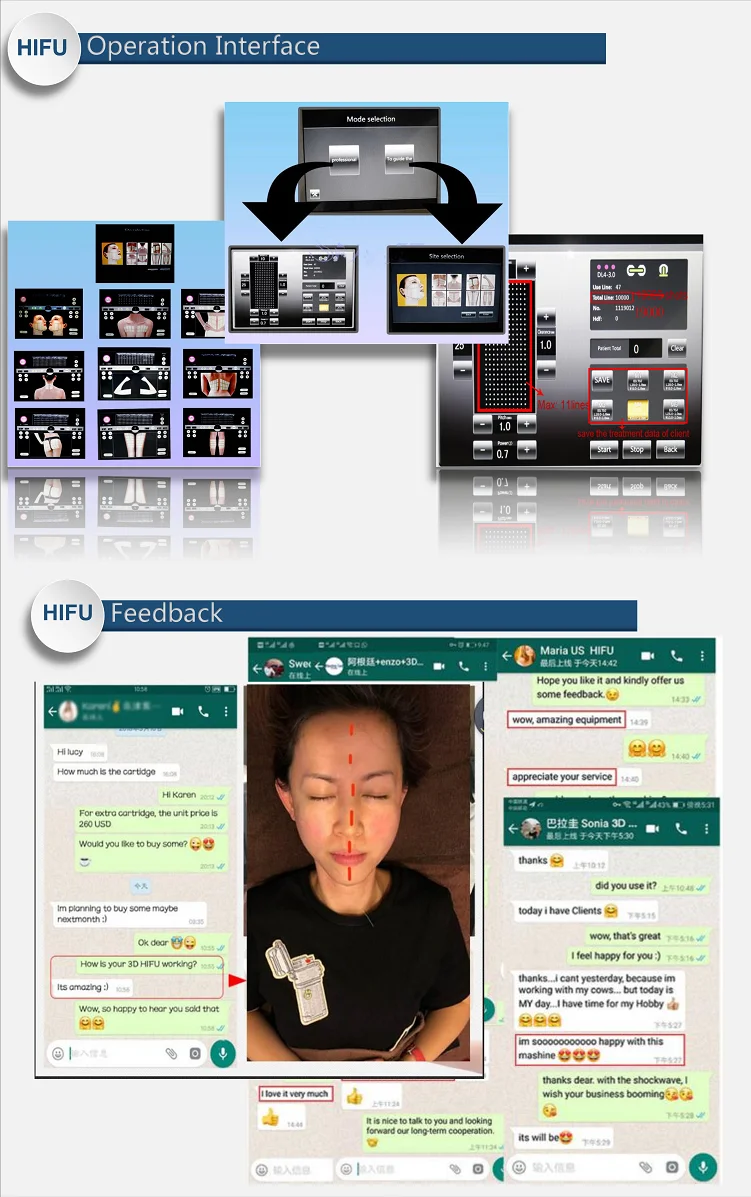 3d hifu focused ultrasound for skin care