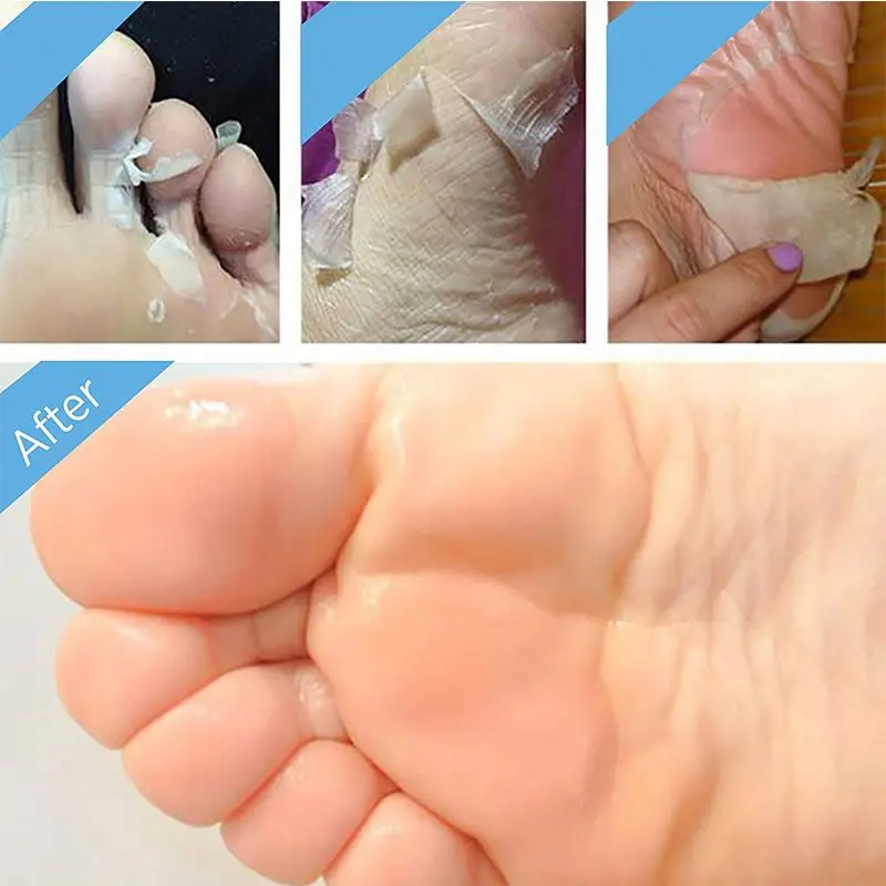 
Foot Peeling Mask Feet Exfoliating Callus Scrub Remove Dead Skin Silky Foot Mask foot mask 