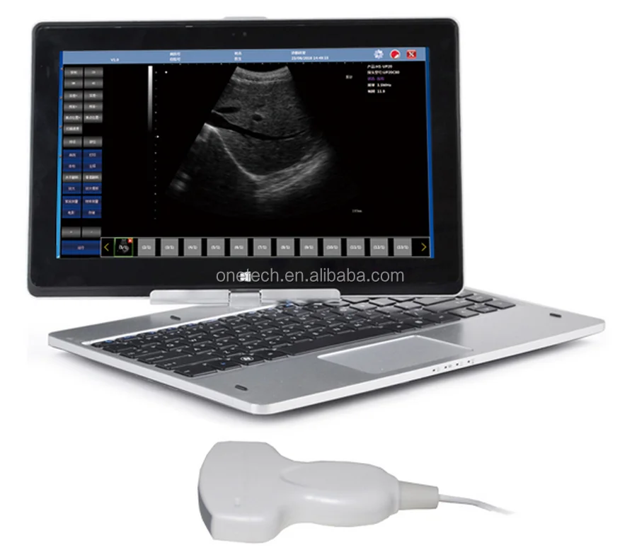Laptop Pc Based Ultrasound Scanner/tablet Ultrasound Scanner/ Usb
